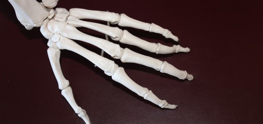 osteoporosi