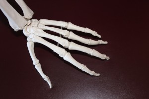 osteoporosi
